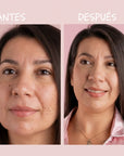 DÚO FACIAL ACLARANTE + PRODUCTO SORPRESA GRATIS | ACLARA EL TONO DE TU PIEL