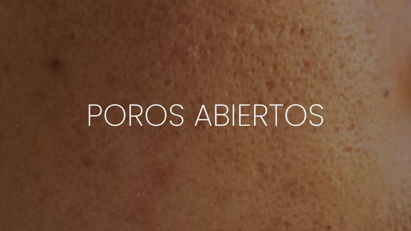 POROS ABIERTOS - Onix Skincare
