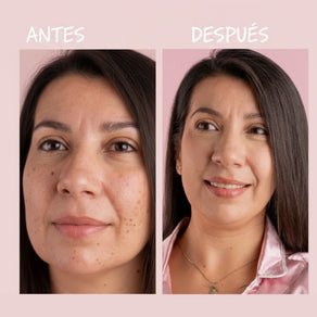 DÚO FACIAL ACLARANTE + PRODUCTO SORPRESA GRATIS | ACLARA EL TONO DE TU PIEL - Hover Image