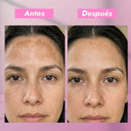 DÚO FACIAL ACLARANTE | ROSTRO SIN MANCHAS - Onix Skincare