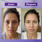 SÉRUM REPARADOR ANTIOJERAS | ADIÓS OJERAS Y BOLSAS - Onix Skincare